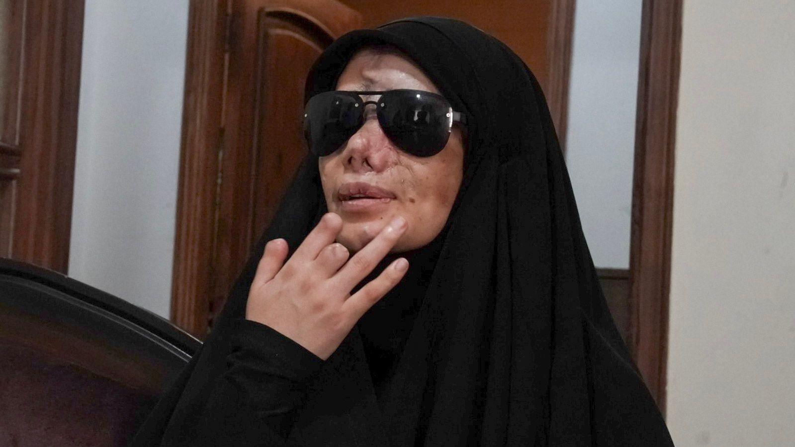 « Je n'ai plus mes yeux » - témoignage d'une victime de l'attaque israélienne à la bombe sonore au Liban