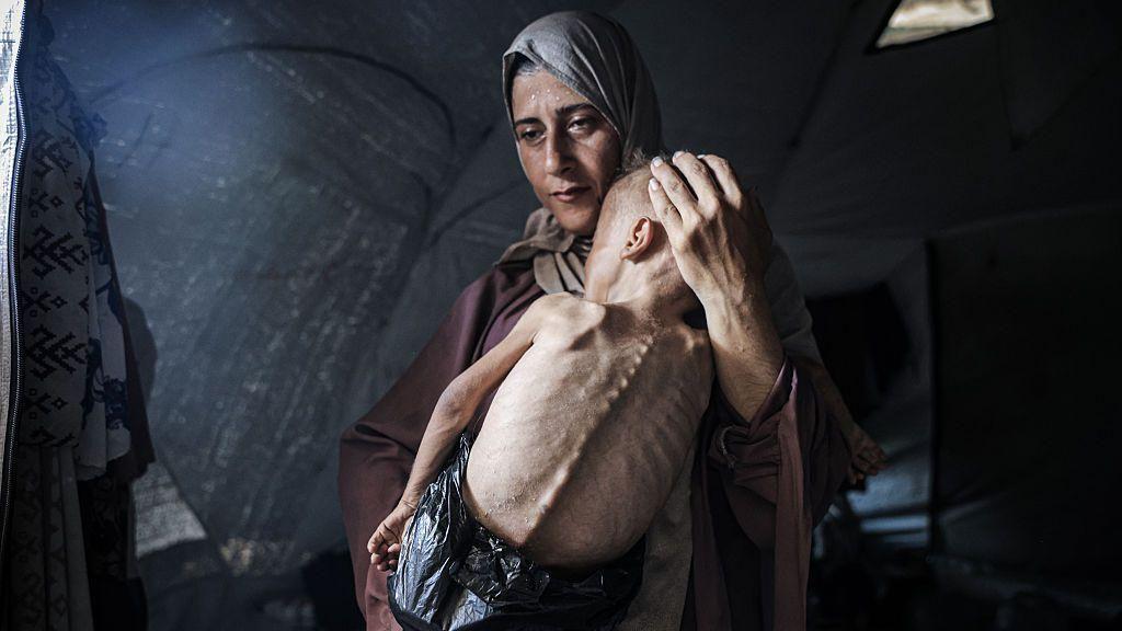 L'histoire de la photo d'Hedaya et de son bébé, l'une des images les plus choquantes de la famine à Gaza