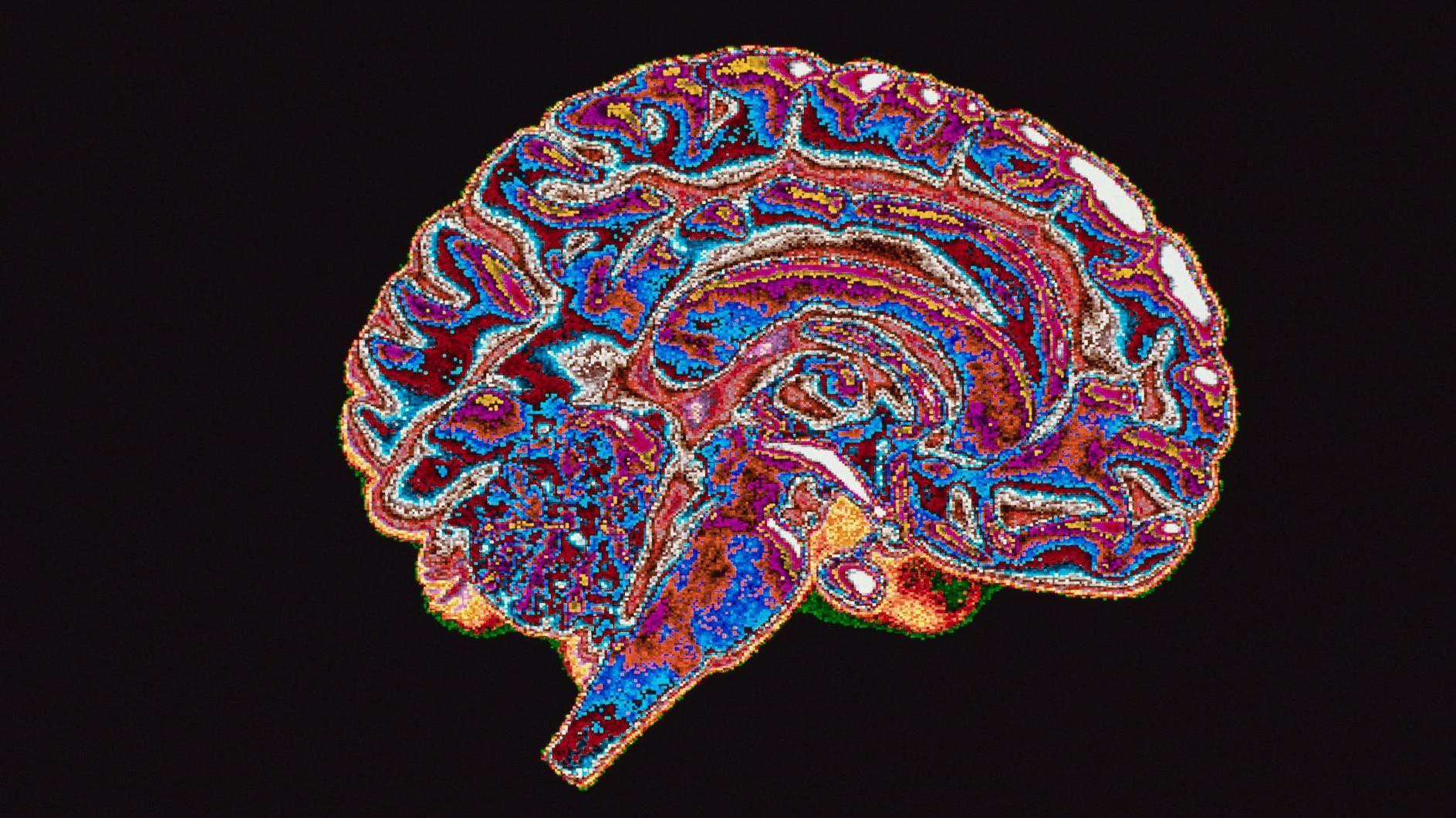 Les humains sont-ils naturellement sujets à la corruption ? Ce que disent les neuroscientifiques