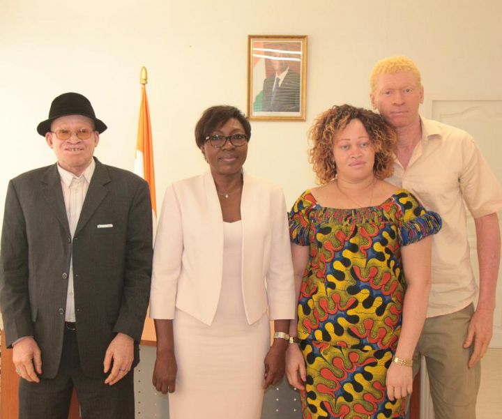 Journée Internationale de Sensibilisation à l’Albinisme: La déclaration de la ministre des Droits de l’Homme et des Libertés Publiques