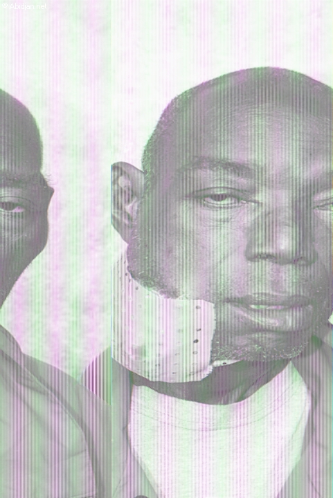 Show-biz: Victime d`une tumeur... SOS pour Mimi Bass, le compositeur de Lougah