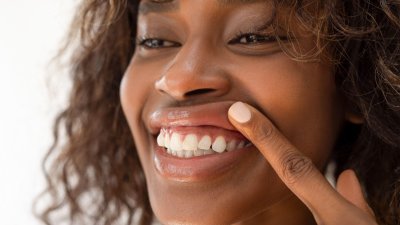 Ce qui peut provoquer le recul des gencives et comment l'éviter