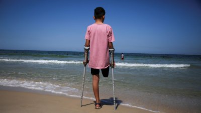 Les personnes amputées à Gaza : privées de soins, de rééducation et de voyage