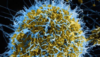 La fièvre LASSA menace la Côte d’Ivoire !