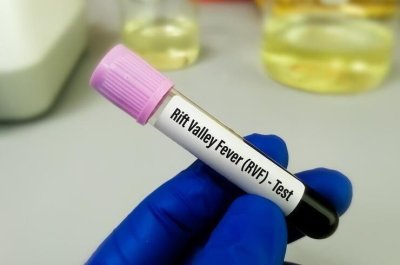 Fièvre de la Vallée du Rift : le Sénégal enregistre plusieurs décès ainsi que plus d'une centaine de cas confirmés