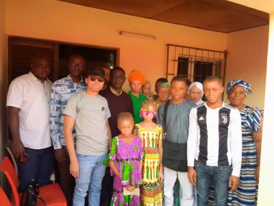 Des séances de consultations médico- sociales pour les albinos à Ferkessedougou