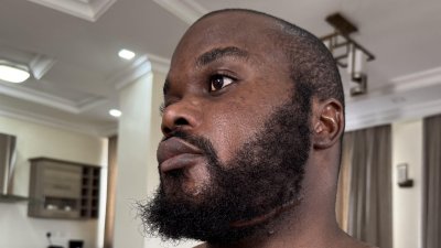 Fusillé et laissé pour mort - Un survivant d'un enlèvement en Tanzanie révèle ce qui lui est arrivé