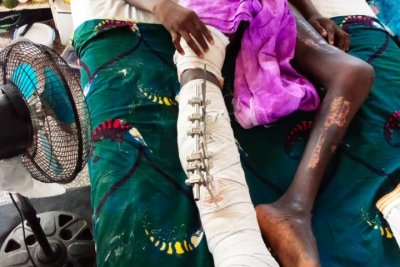 L’Enquête du jeudi / Accidents de la circulation. (1/2)- Les motos à l’origine des plus graves dégâts corporels des victimes