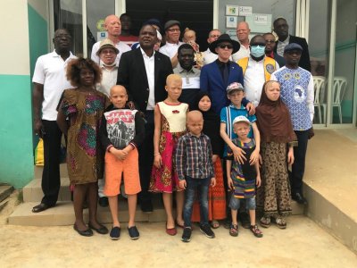 Programme de consultation santé pour Albinos 100% gratuit: Aube Nouvelle aux côtés des populations vulnérables