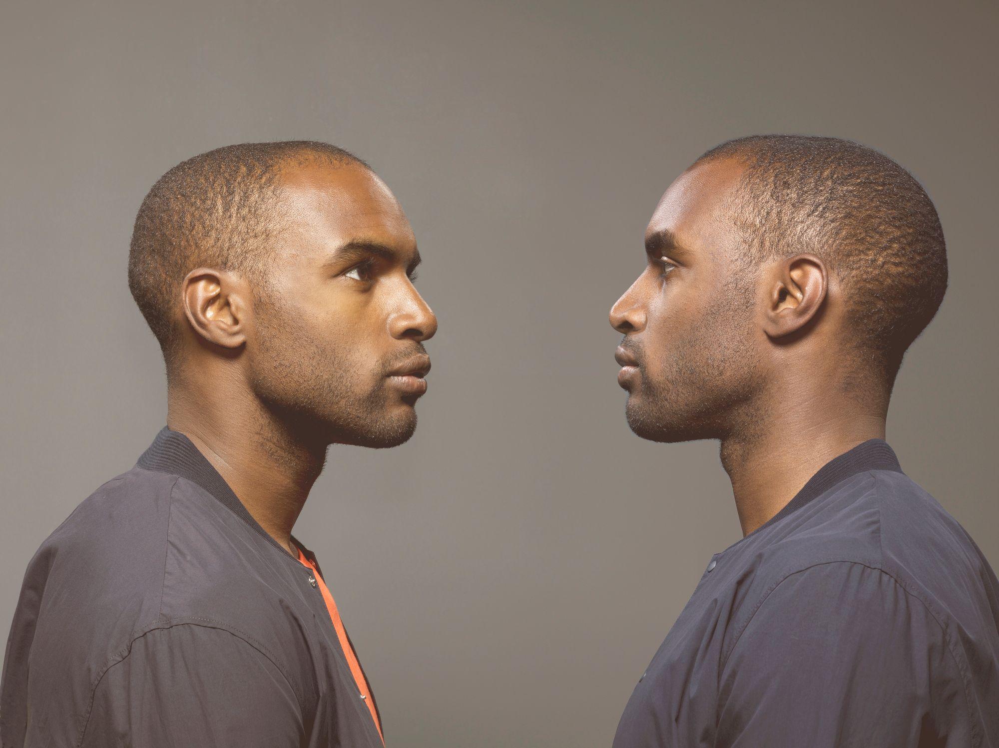 Nature ou culture ? Les traits inattendus partagés par les jumeaux identiques 