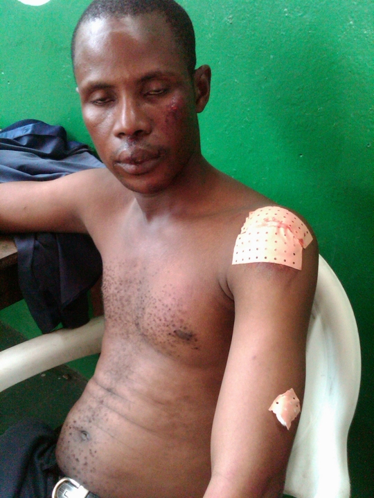 Municipales à Treichville : Un pro-Amichia blessé, des affiches déchirées