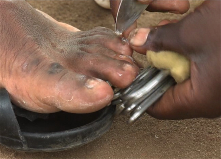 Coupeurs d’ongles ambulants, le métier nourrit son homme