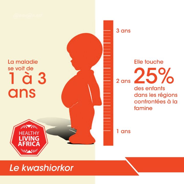 Santé infantile/ Les protéines pour les enfants : comment grandir sain en évitant le kwashiorkor