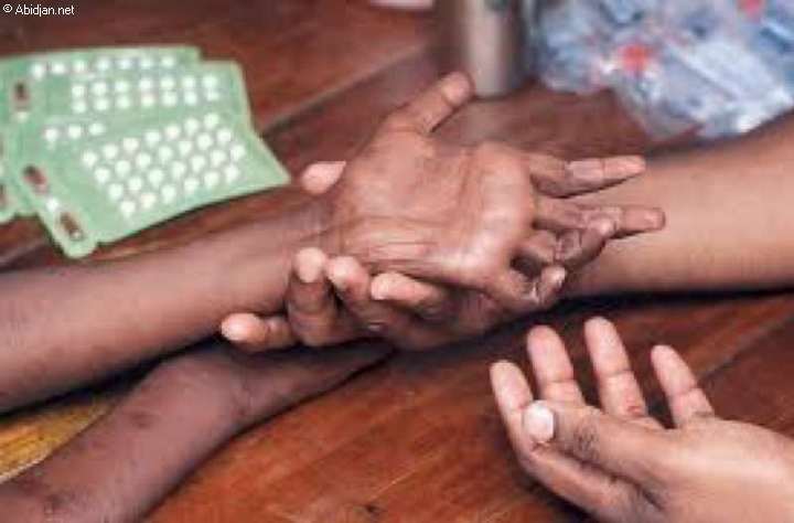 Quinze nouveaux cas de lèpre enregistrés en 2014 à Yamoussoukro