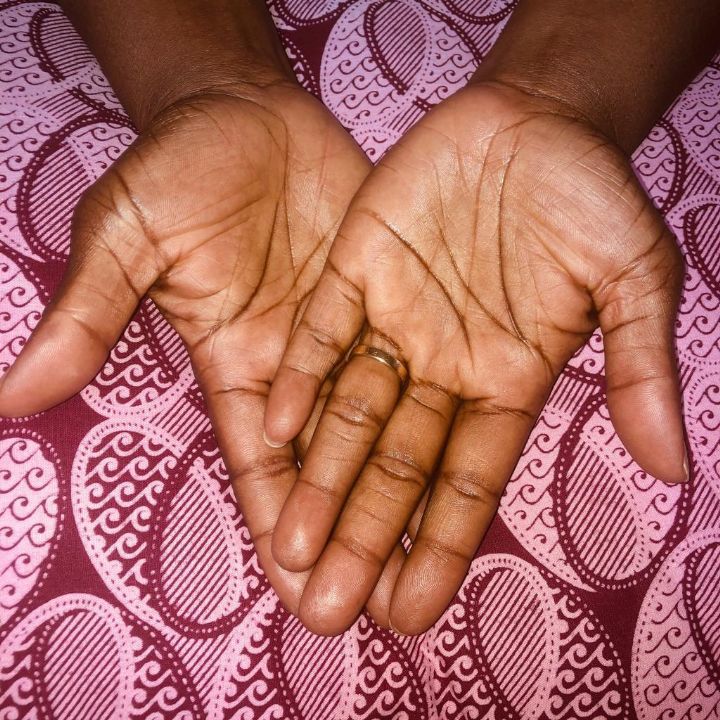 Journée Internationale de la drépanocytose: l’association Maison Doonia veut accentuer la sensibilisation