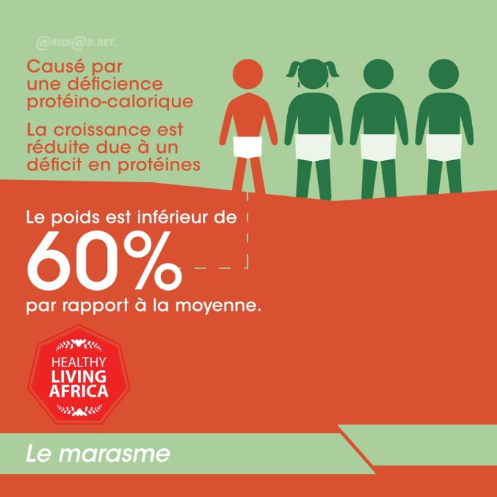 Santé/ Comment mettre son enfant à l’abri du marasme