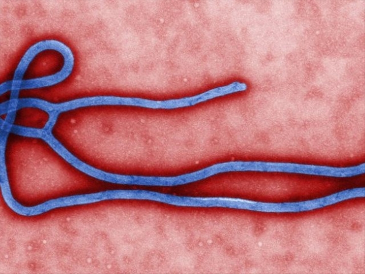 Ebola / des fragments de virus peuvent persister dans le sperme pendant au moins neuf mois (Etude)